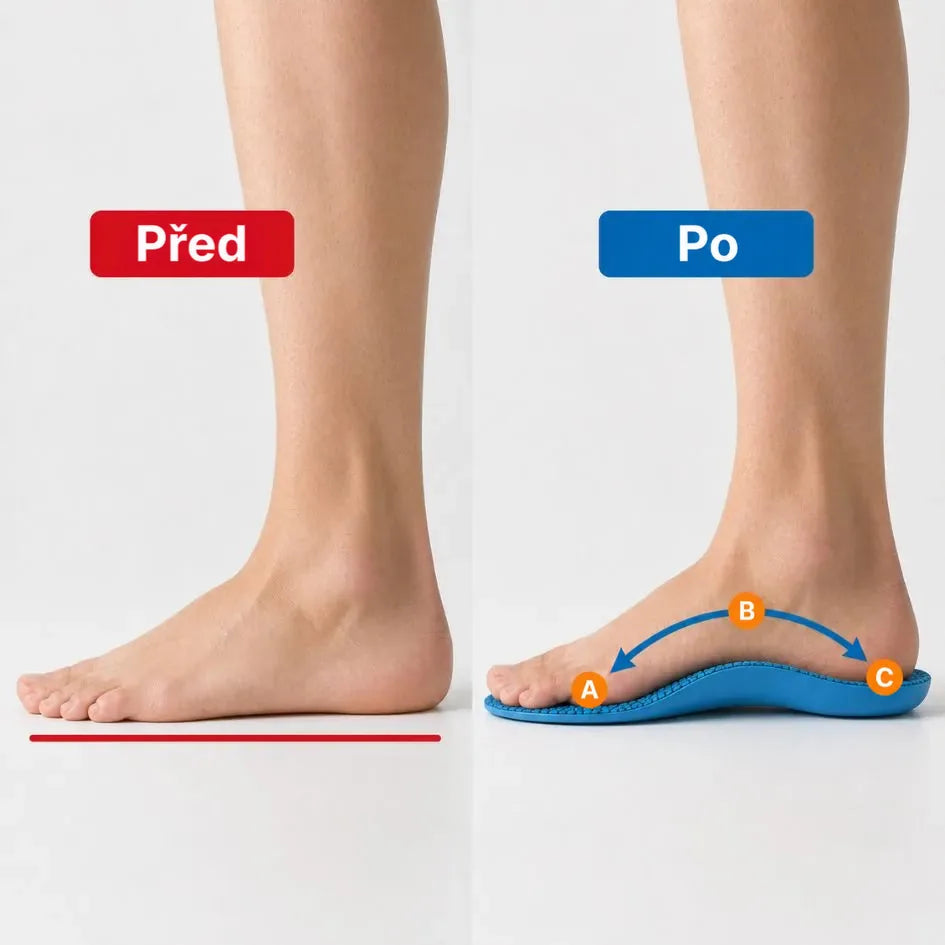 Ortopedické vložky Oliviaro