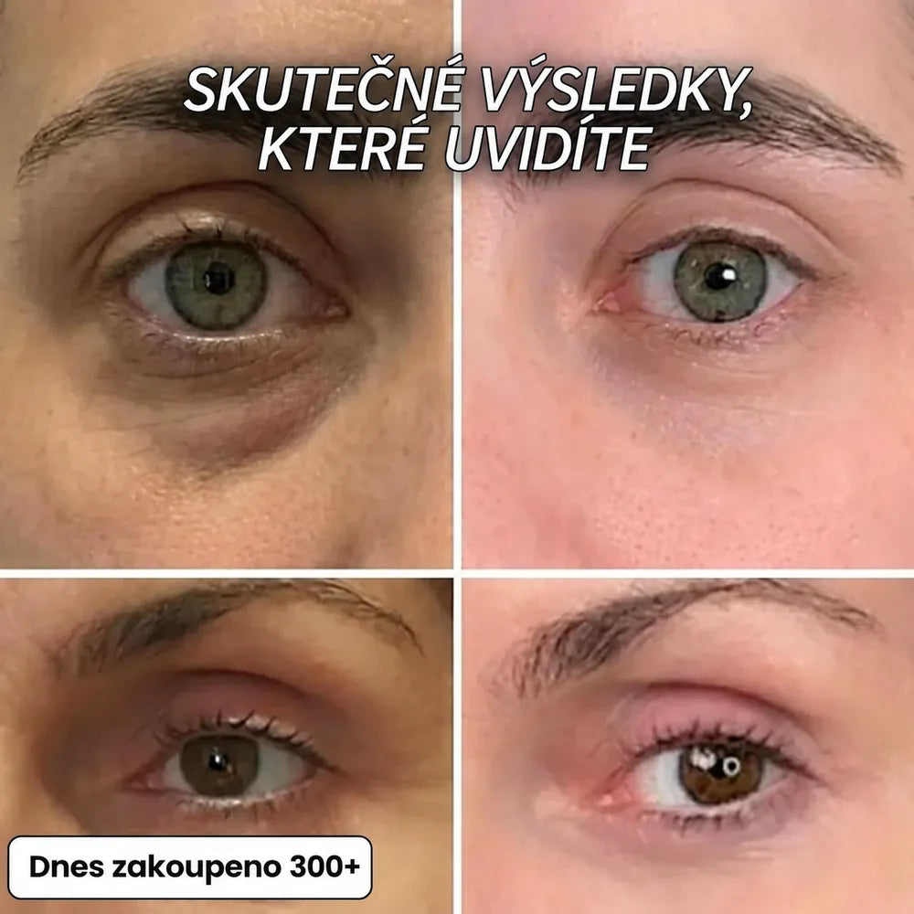 Vyplňující Stick proti Vráskám