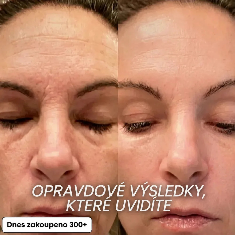 Vyplňující Stick proti Vráskám